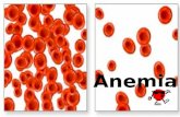 Anemia - Leucemia