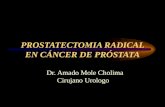 Prostatectomia Radical