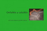 onfalitis celulitis