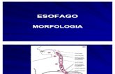 Esofago - Barret. Cancer