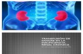 Transfusión de Sangre en la Insuficiencia Renal Crónica