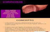 Cirrosis e hipoglicemia