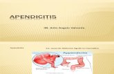 apendicitis jhon