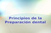 Principios de la Preparacion Dental