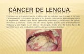 5.1 Cancer de Lengua