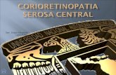 Corioretinopatia Central Serosa