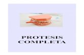 Protesis Complet
