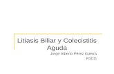 Litiasis Biliar y Colecistitis