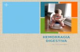 Hemorragia digestiva  2013