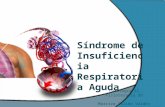 Síndrome de insuficiencia respiratoria aguda - SIRA