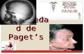 Paget's disease