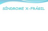 Síndrome x frágil pwp