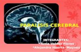 70131351 paralisis-cerebral