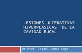 Lesiones ulcerativas hiperplasicas  de la cavidad bucal
