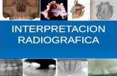 Interpretacion radiografica sin editar.