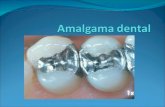 Ventajas y desventajas de la amalgama dental blog
