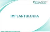 Implantologia Clinica Odontologica Dentilaser