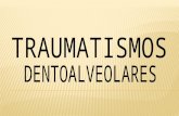 Traumatismos dentoalveolares