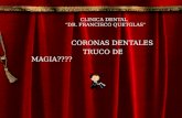 Coronas Dentales Truco De Magia