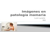 Imágenes en patología mamaria