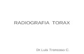 239 -  Radiografia  Torax