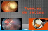 Tumores de retina