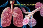 Asma en el adulto
