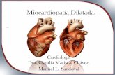 Miocardiopatía dilatada.