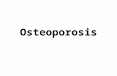 Osteoporosis oeste (2)