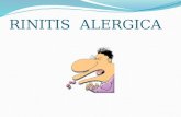 3 rinitis  alergica
