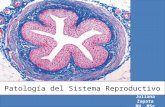 Patologia de sistema reproductivo
