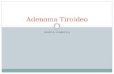Adenoma tiroideo