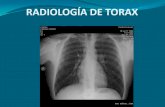 Radiografia torax