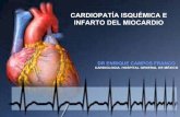 Cardiopatía Isquemica e Infarto Agudo de Miocardio