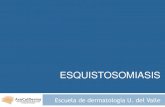 Esquistosomiasis: Qué es?