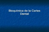 Bioquímica de la caries dental