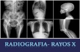 Tecnicas Radiografica