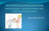 Histerosalpingografia y alteraciones del tracto mülleriano karen