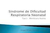 Síndrome de dificultad respiratoria neonatal tipo i