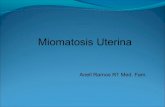 Miomatosis    uterina