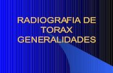 Generalidades de la Radiolog­a De T³rax