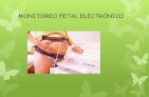 Monitoreo fetal electrónico