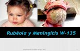 Rube³la & Meningitis W-135