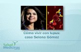 Selena G³mez sufre lupus, qu© es y s­ntomas