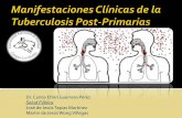Manifestaciones clínicas de la tuberculosis