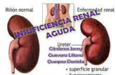 1. insuficiencia renal aguda