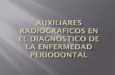 Radiografia En La Enfermedad Periodontal Edison Gonzalez 982436 Tpi 2009 2