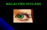 Malalties oculars (2)