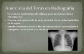 Anatomía del tórax en radiografía