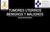 Tumores uterinos benignos y malignos